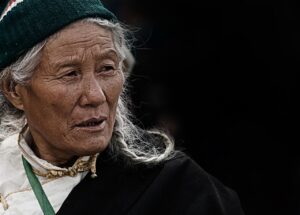 女性の薄毛外来の口コミは本当に役立つ？